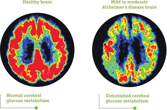 brain scans