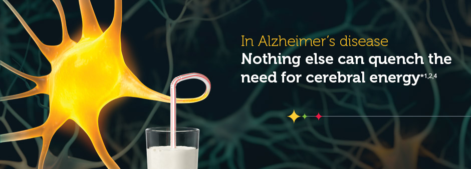 Alzheimer's disease-DCGM deprives the brain of energy it needs