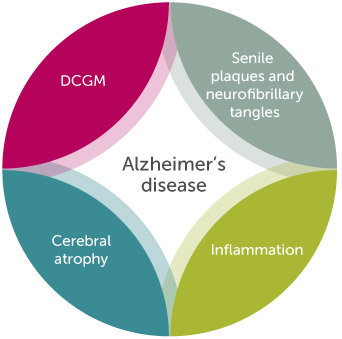 Alzheimer's disease characteristics chart